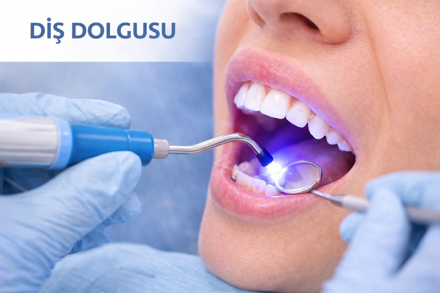 Diş Dolgusu