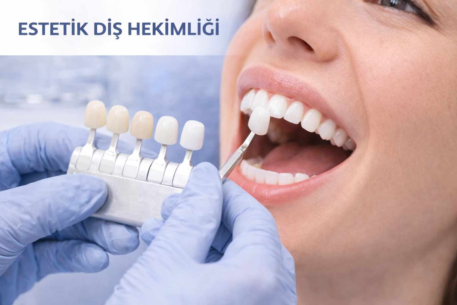 Estetik Diş Hekimliği