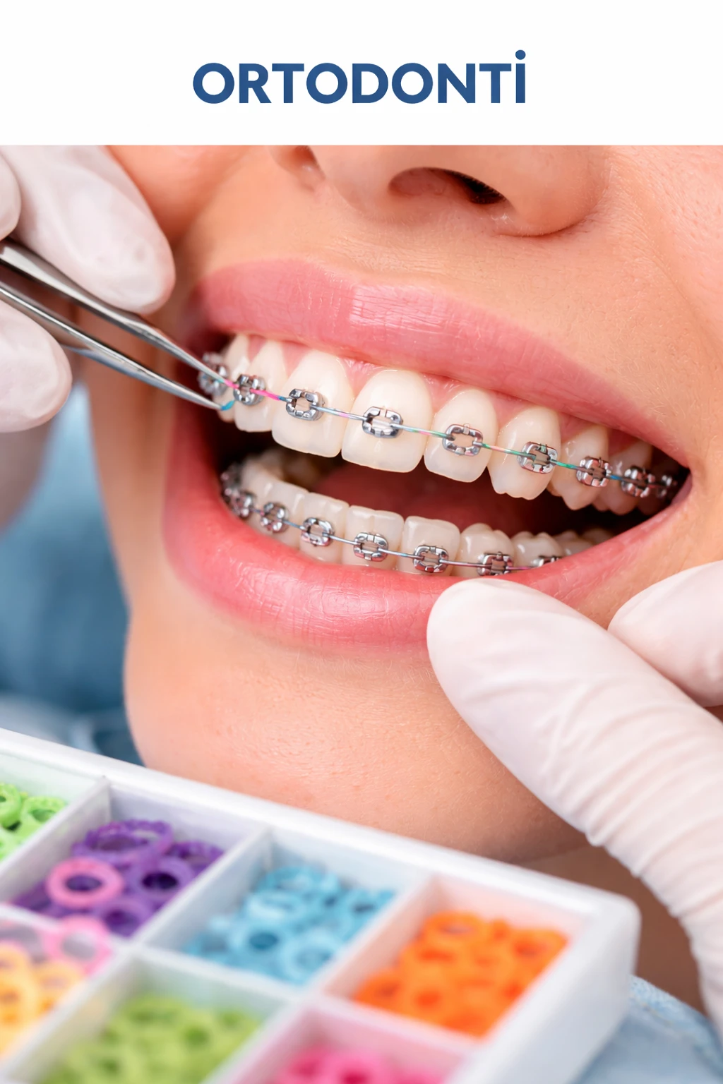 Ortodontik Tedavi